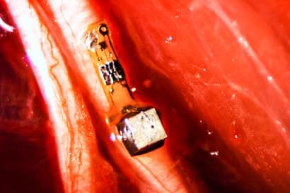Neural Dust sensors inside humans can monitor and treat disease