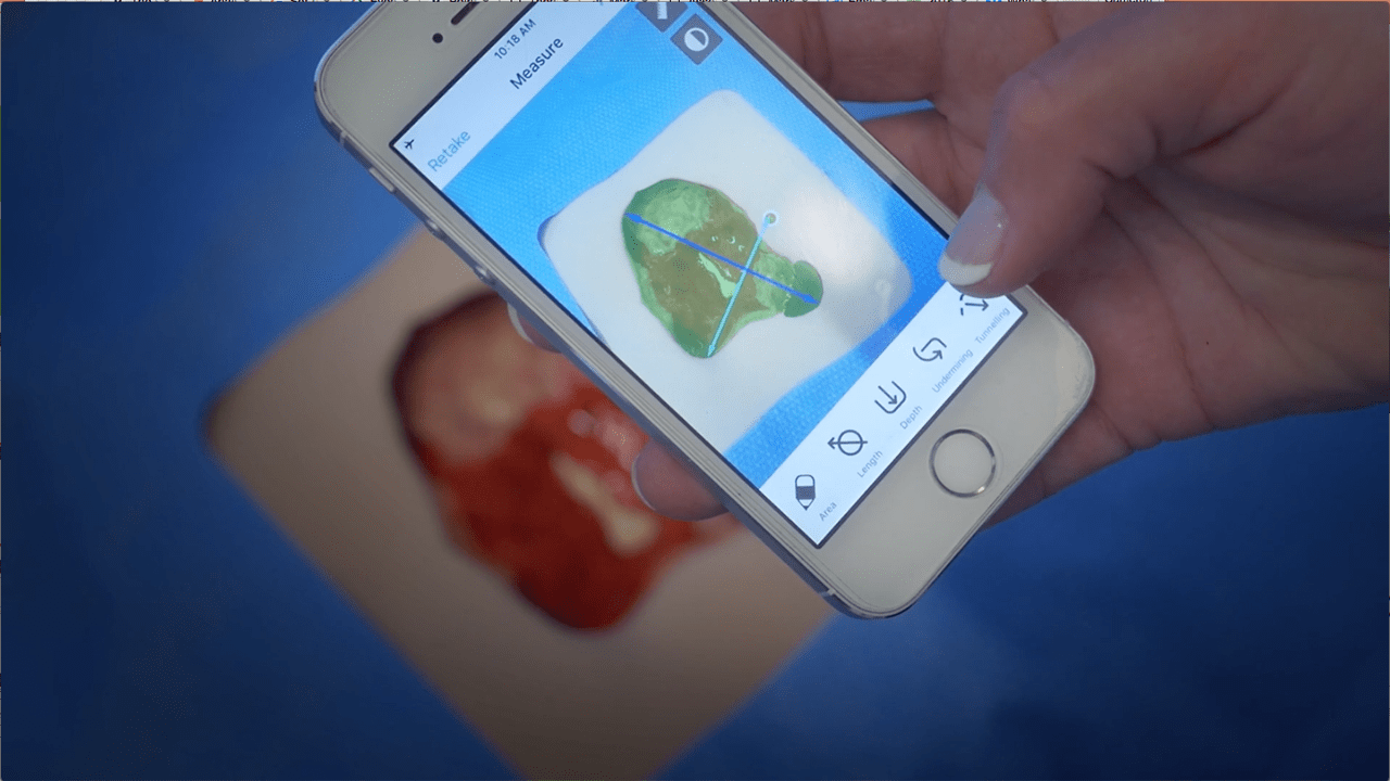 PointClickCare Launches Skin and Wound Smartphone App ...