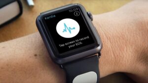 KardiaBand Apple Watch FDA