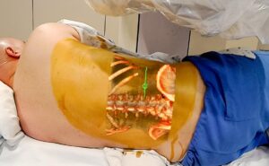 Hololens FDA surgery AR